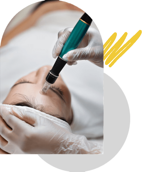 خدمات میکرونیدلینگ
