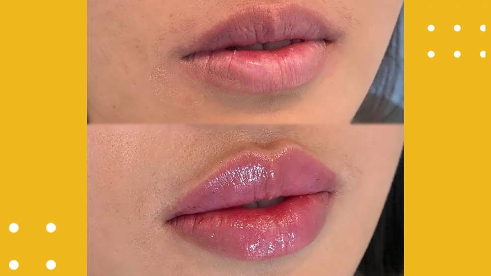 تکنیک لب روسی دقیقاً چگونه است و چگونه اجرا می شود؟