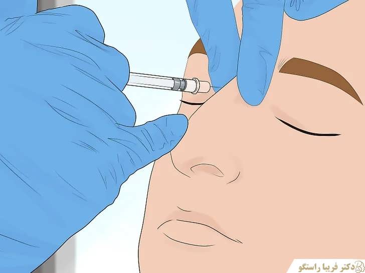 می توانید از فیلر بینی استفاده کنید