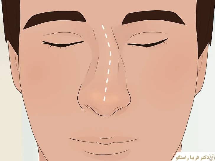 بینی ها تغییر شگل می دهند