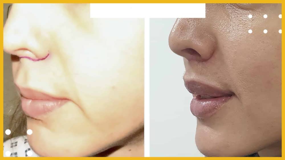 چه افرادی کاندیدای مناسب برای سانترال لب هستند؟