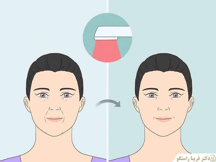 مقابله با پیری و ریزش مو با نور درمانی